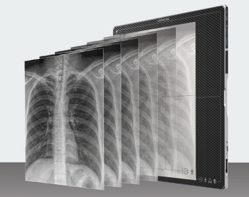 VIVIX-S-F DR Panels